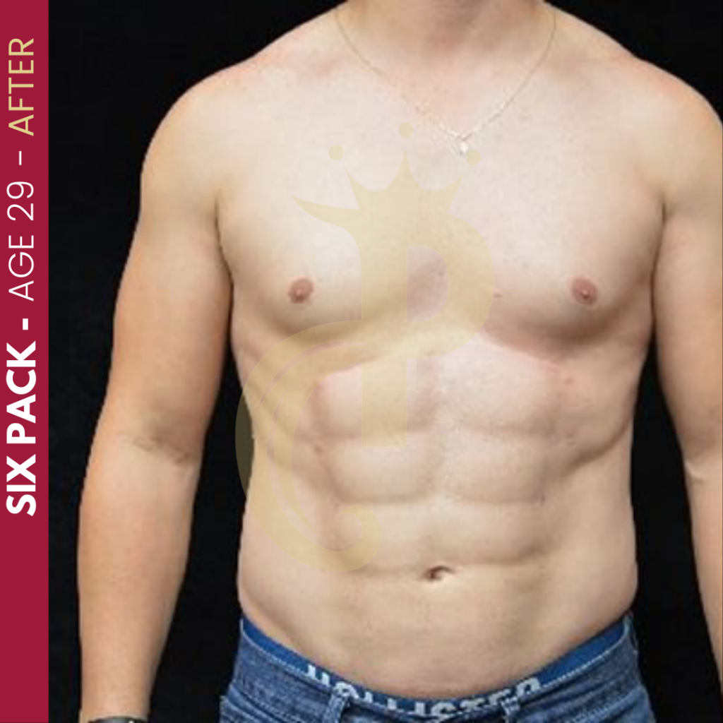 Six Pack Before and After