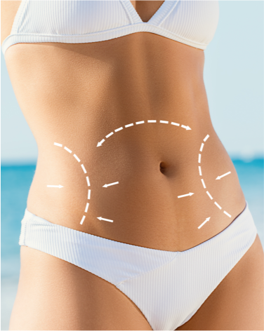 Tummy Tuck Turkey - Tummy Tuck in Turkey Your Journey to a Toned Waistline