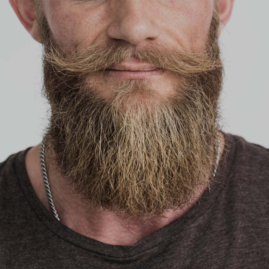 beard transplant 1024x1024 1