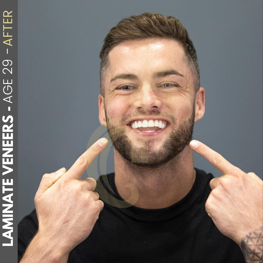 Zirconia Crown in Turkey Cost, Procedure, Best Clinic Pixl Clinic