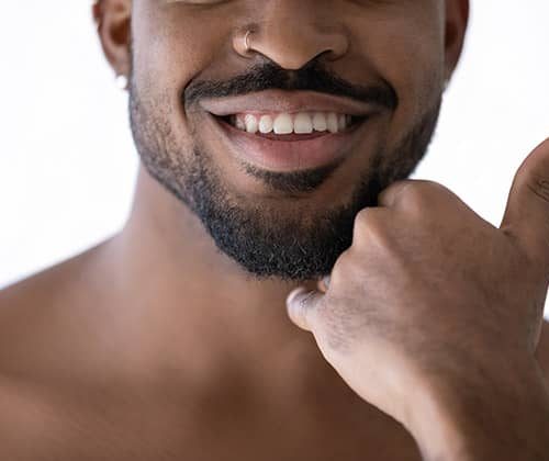 Afro-Beard-Transplant-in-Turkey-