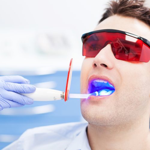 Blanqueamiento dental en Turquía