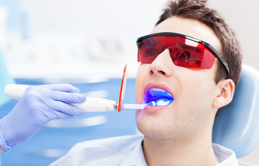 Blanqueamiento dental en Turquía 1 Blanqueamiento dental en Turquía