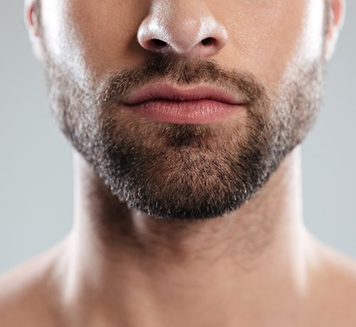 Facial-Hair-Transplant