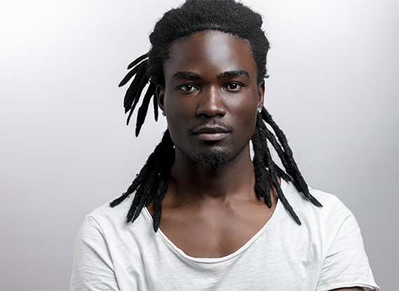 Hair Transplant with Dreadlocks in Turkey 1 Hair-Transplant-with-Dreadlocks
