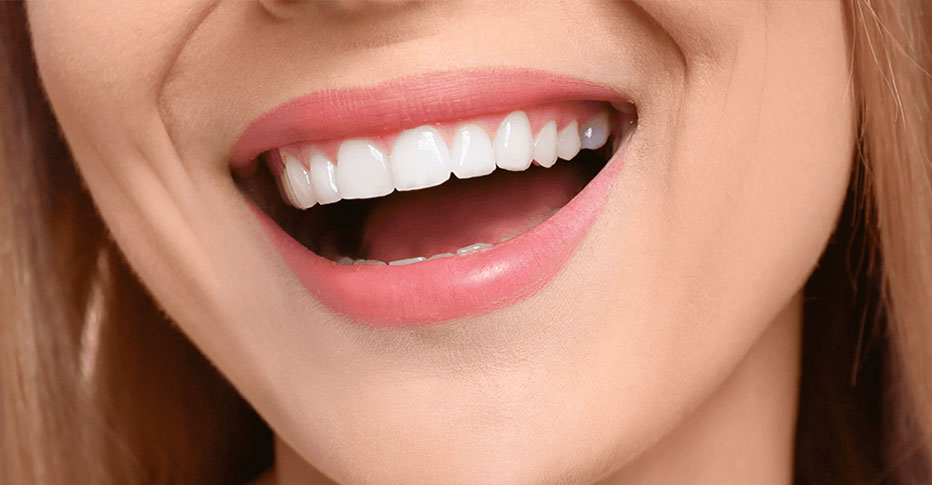 Hollywood Glimlach in Turkije 1 Hollywood-glimlach in Turkije Het bereiken van een Hollywood-glimlach in Turkije is niet alleen betaalbaar, maar biedt ook toegang tot topkwaliteit zorg en de kans om een prachtig land te verkennen. Met deskundige behandelingen en persoonlijke zorg kun je je glimlach transformeren en je zelfvertrouwen een boost geven. Hollywood glimlach in Turkije: Bereik de sterrenkwaliteit glimlach die je altijd al wilde hebben De “Hollywood-glimlach” is een term die synoniem staat voor oogverblindende, onberispelijke tanden die zelfvertrouwen en charme uitstralen. Het is het soort glimlach dat vaak te zien is bij beroemdheden en filmsterren, en het is nu binnen uw bereik met behandelingen in Turkije.