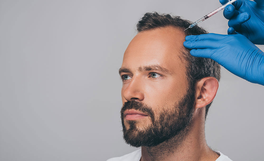 Injection PRP Cheveux en Turquie 1 Injection-PRP-Cheveux-en-Turquie