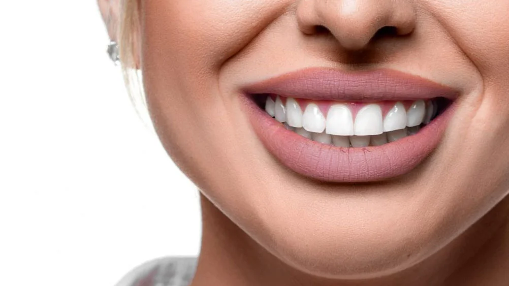 Rifacimento del sorriso in Turchia 1 Rifacimento del sorriso in Turchia