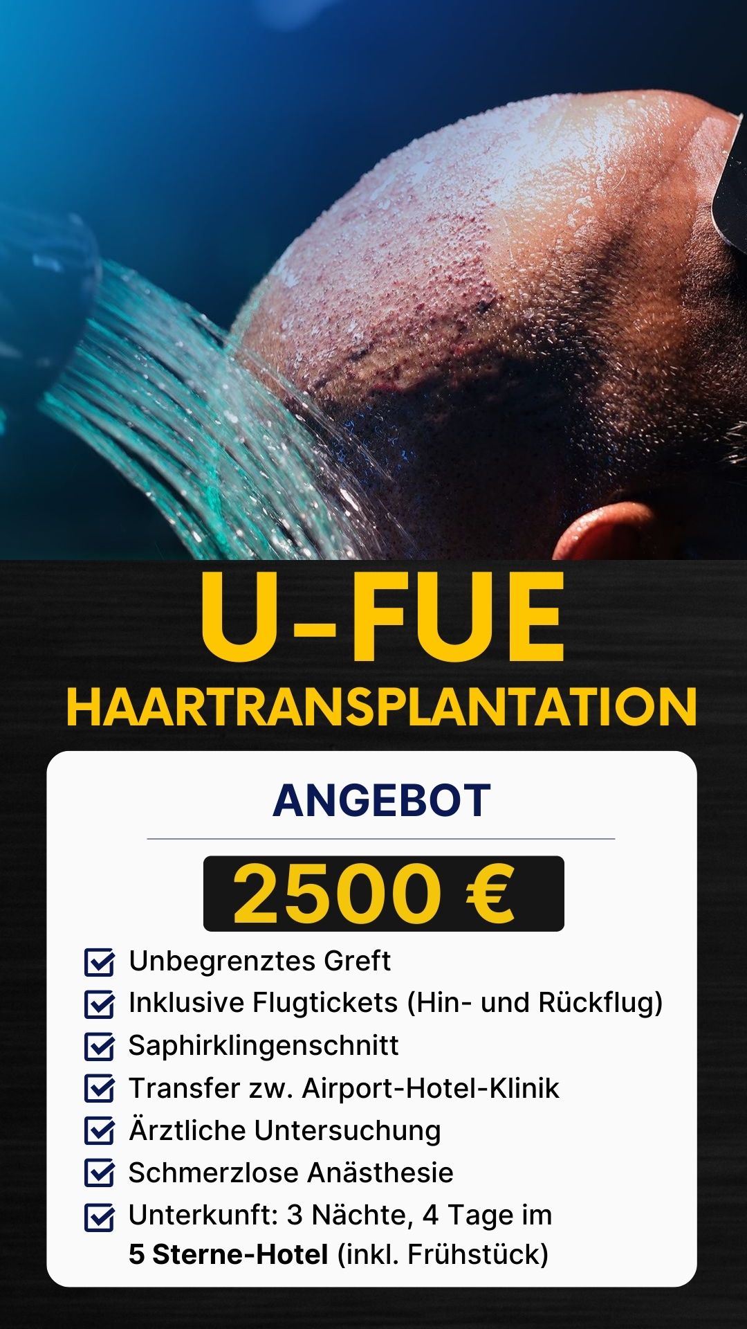 U-FUE HaartransplantatIon