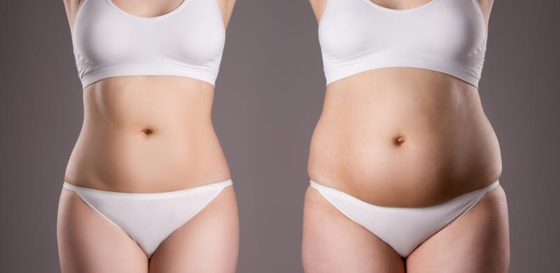 Abdominoplastie en Turquie 1 svg+xml;charset=utf