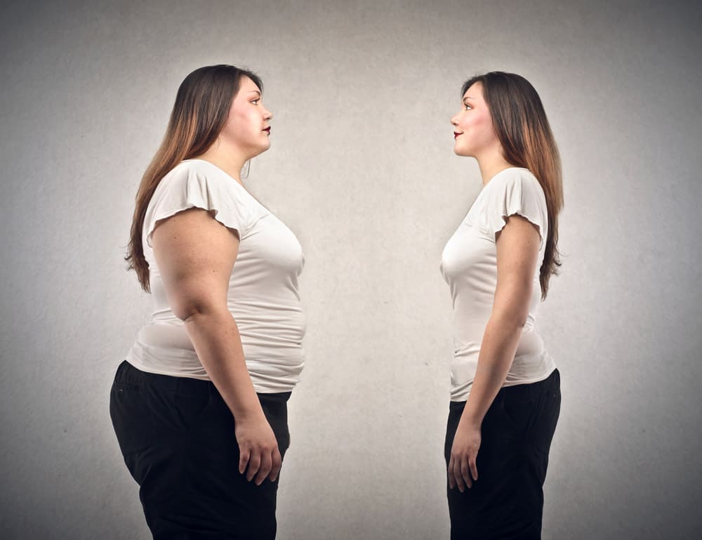 Bariatric Surgery in Turkey 1 Bariatric-Surgery-Turkey.
