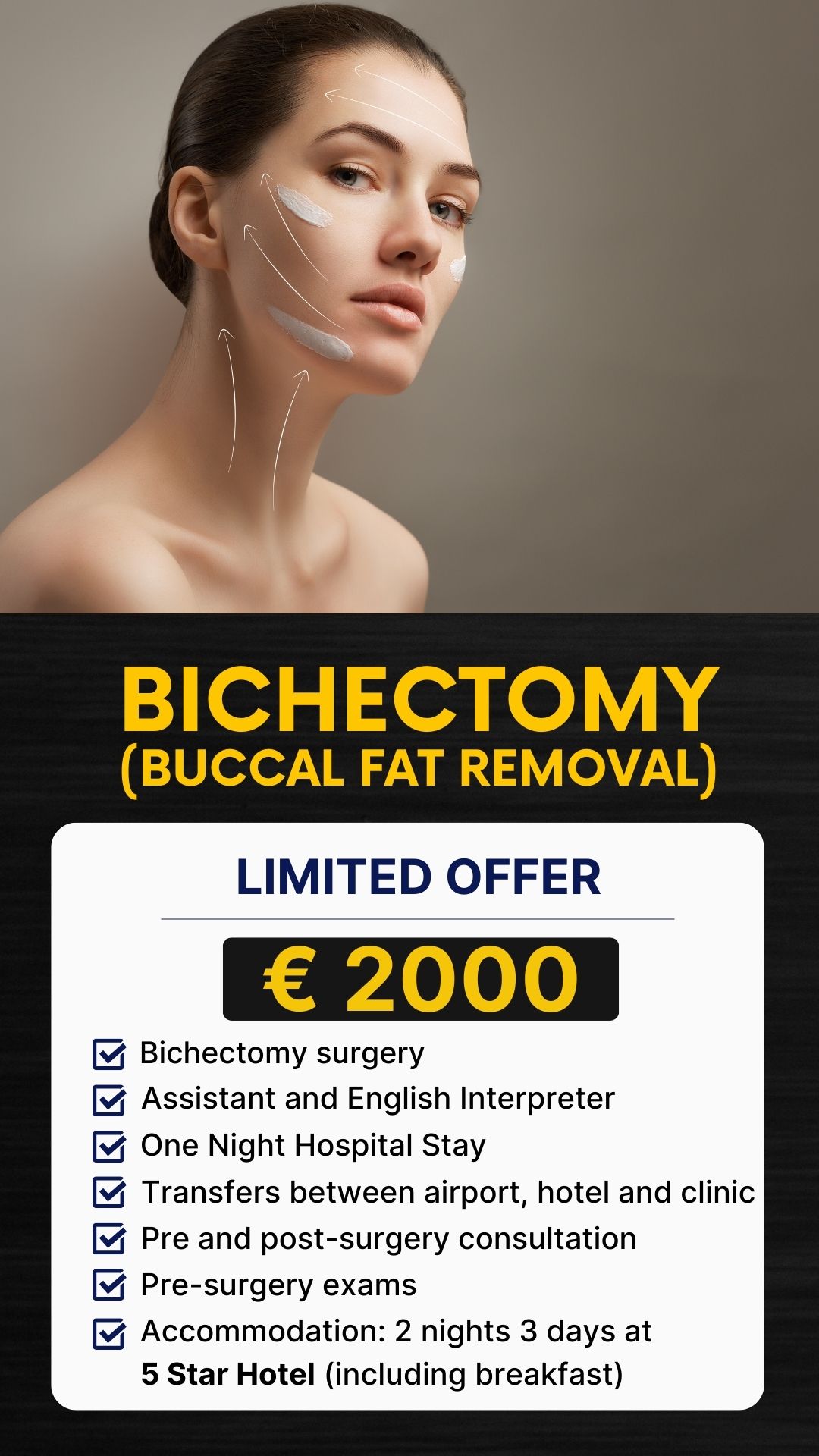 Bichectomy