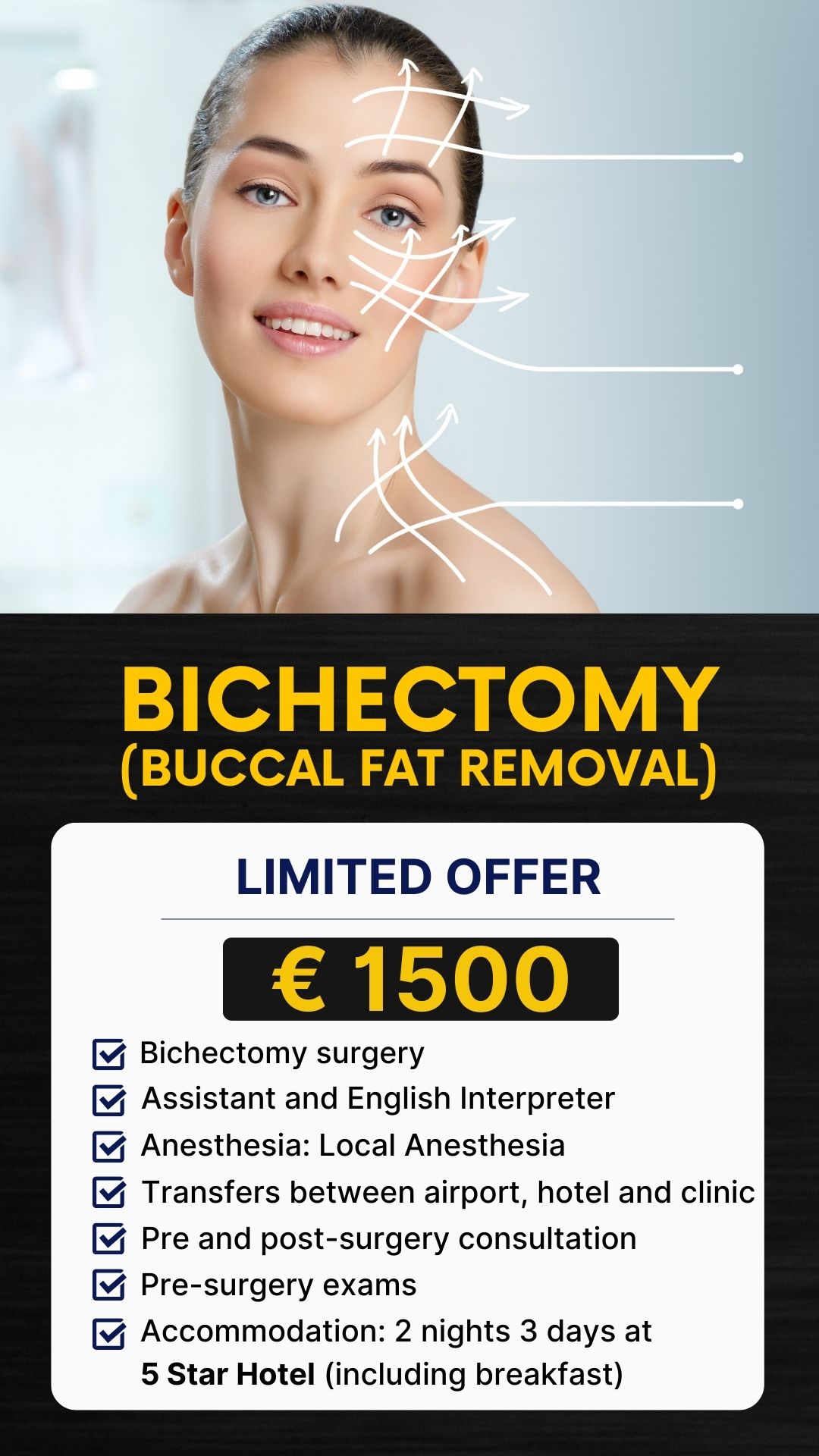 Bichectomy