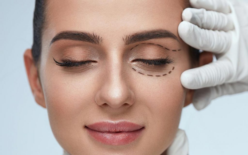 Chirurgia delle palpebre in Turchia 1 Chirurgia delle palpebre in Turchia