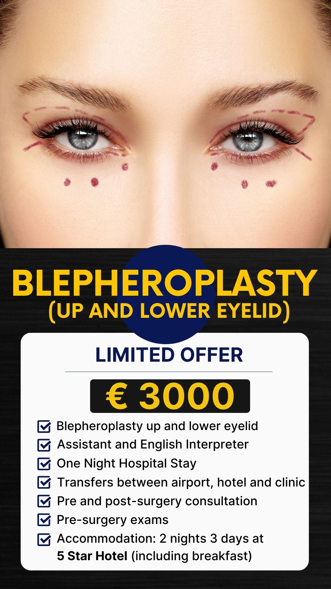 Blepheroplasty