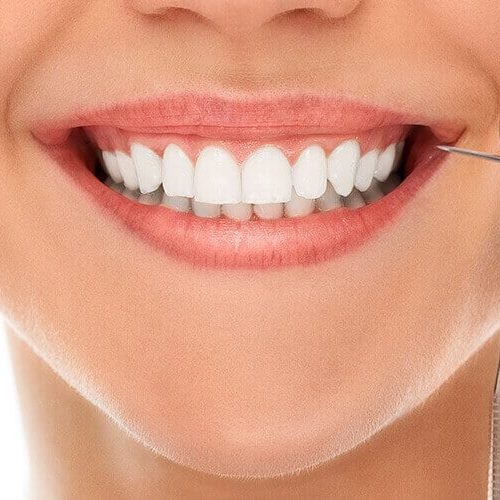 Estética dental en Turquía