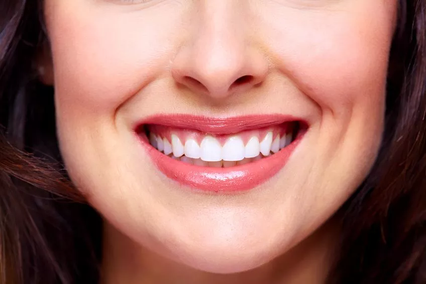 Estetica dentale in Turchia 1 Estetica dentale in Turchia