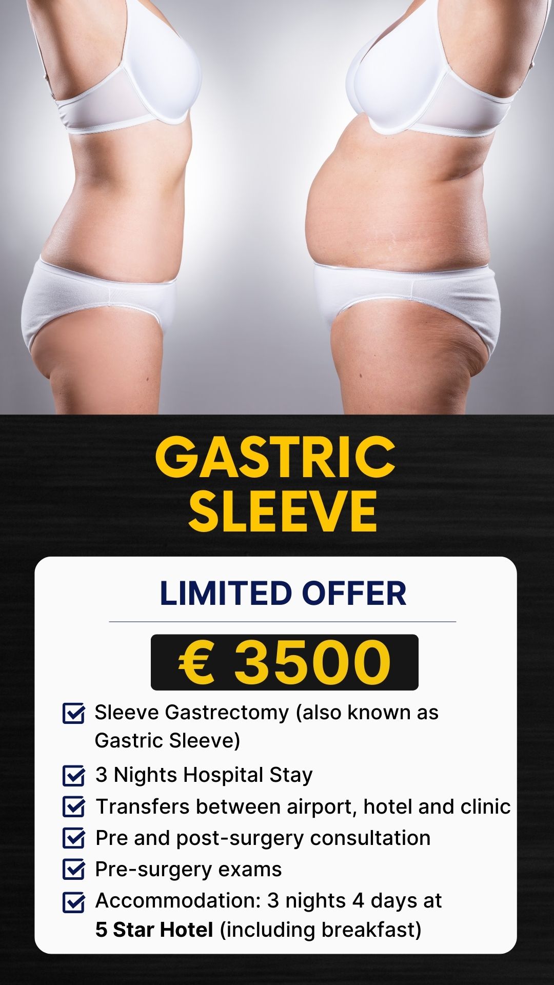 Gastric slevee