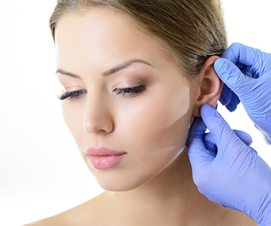 Otoplastia en Turquía 1 Otoplastia en Turquía
