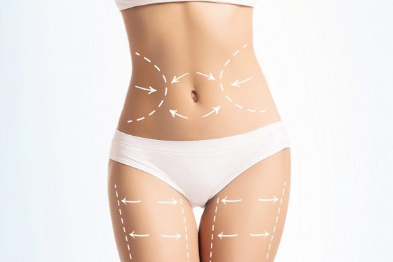 Pubic Lift in Turkey 1 Pubic-Lift-in-Turkey