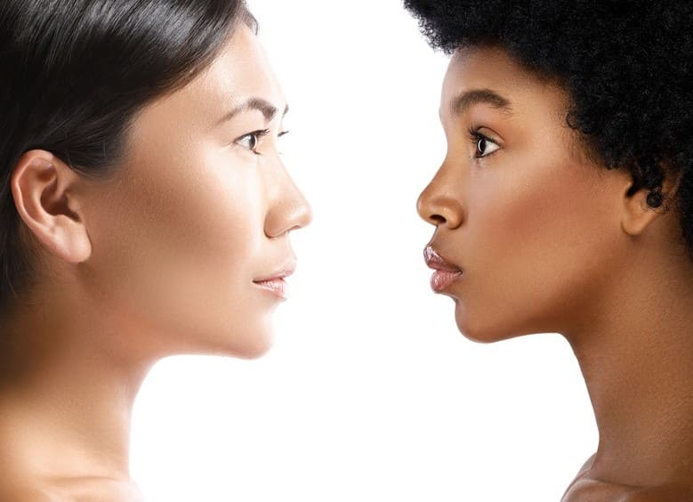 Rhinoplastie ethnique en Turquie 1 Rhinoplastie-ethnique-en-Turquie