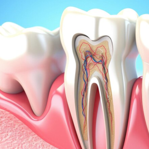 Root-Canal-Treatment-Turkey