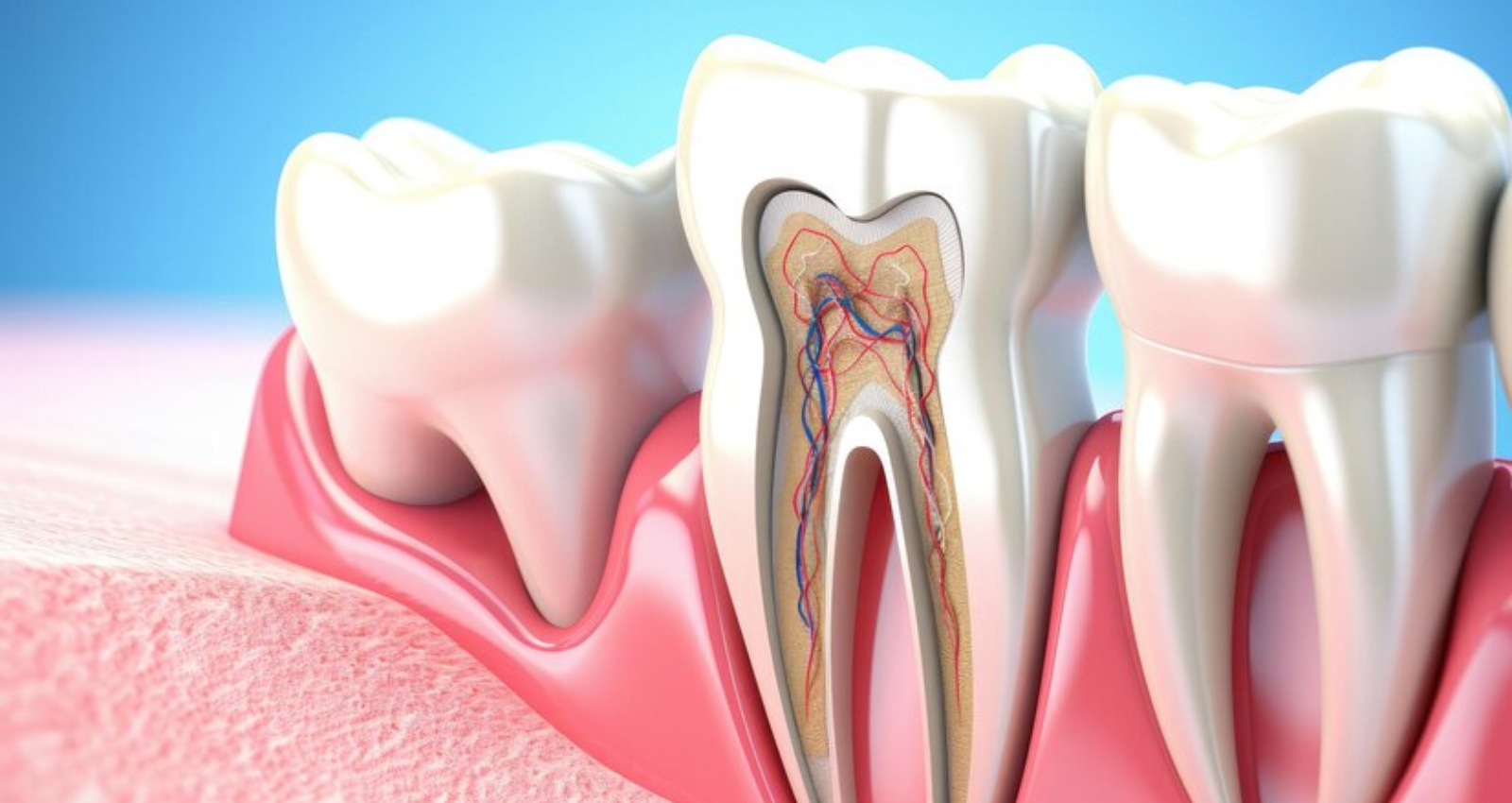 Root Canal Treatment in Turkey 1 Root-Canal-Treatment-Turkey