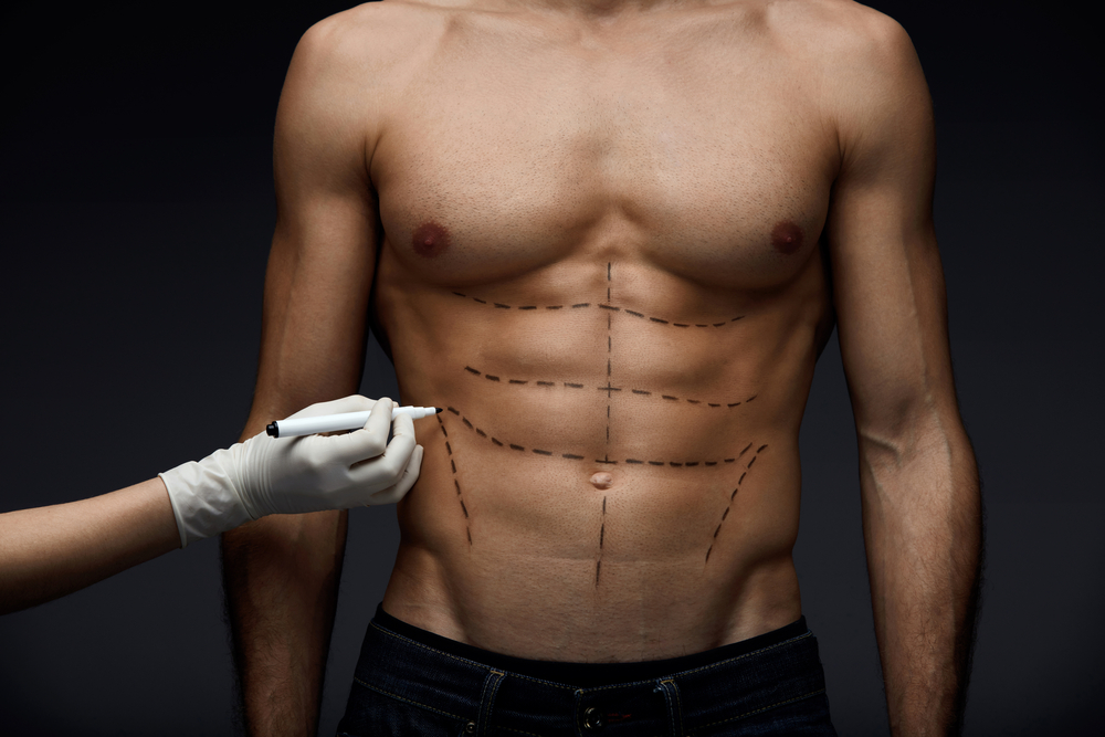 Six Pack chirurgie in Turkije