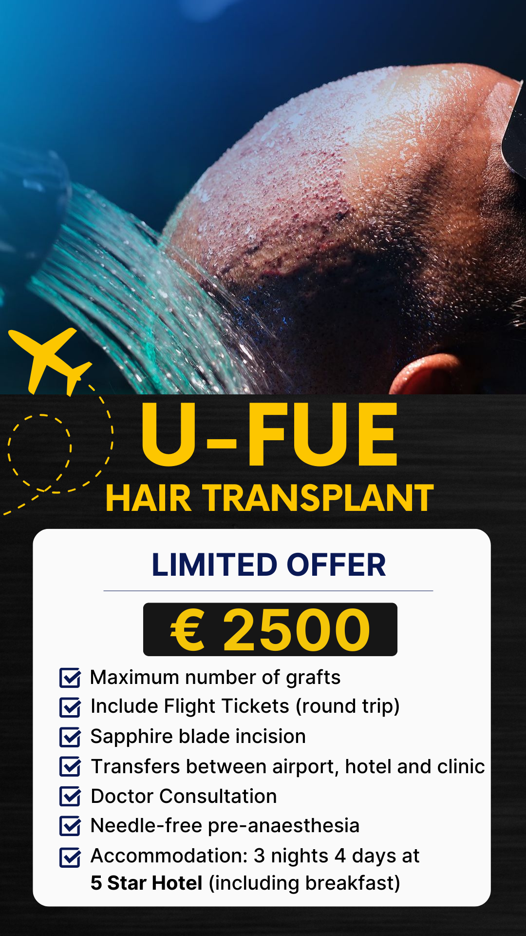 U-FUE-hair-transplant