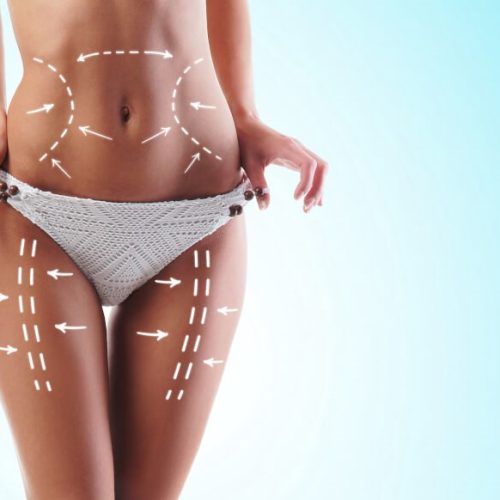 Vaser-Hi-Def-Liposuction-in-Turkey