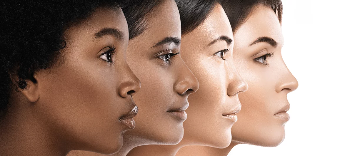 Этническая ринопластика в Турции 1 Этническая ринопластика в Турции