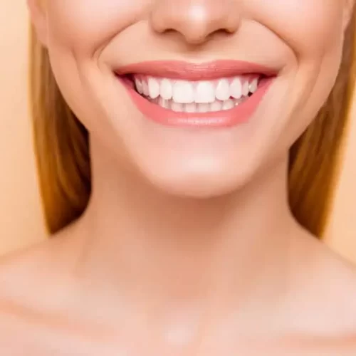 Achieving Perfect Teeth in Three Simple Steps: Your Guide to a Flawless Smile