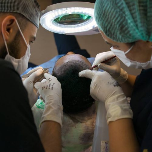 Alternatives to Hair Transplant Surgery: Effective Solutions for Hair Loss