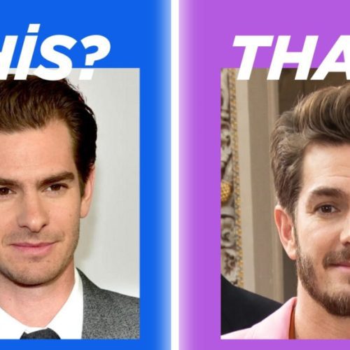 Andrew Garfield Hair Transplant