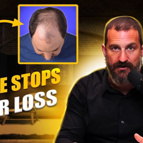 Andrew Huberman on Hair Loss and Hair Growth: Insights from Science