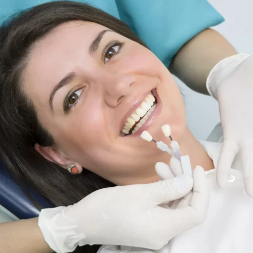 Are Veneers Permanent? How Long Can You Expect Them to Last?