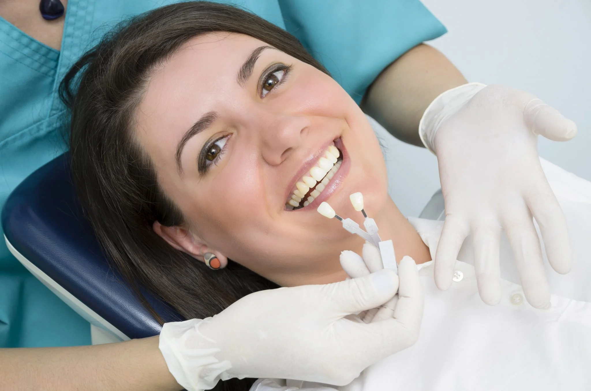 Are Veneers Permanent? How Long Can You Expect Them to Last? 1 Are Veneers Permanent? How Long Can You Expect Them to Last?