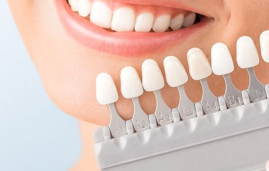 Are Yellow Teeth Stronger than White Teeth? Exploring the Myths and Facts 1 Are Yellow Teeth Stronger than White Teeth? Exploring the Myths and Facts