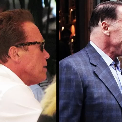 Arnold Schwarzenegger Hair Transplant