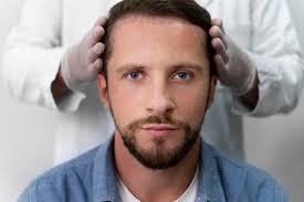 At What Age Should I Get a Hair Transplant? A Guide to Making the Right Decision