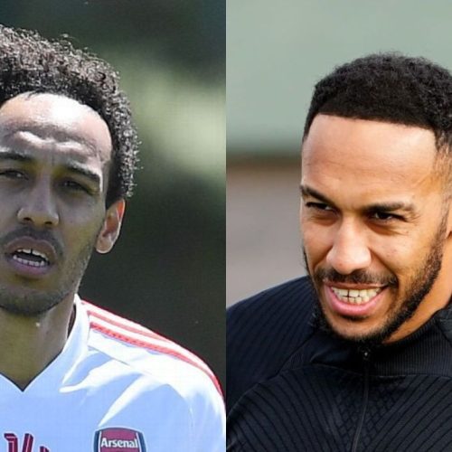 Aubameyang Hair Transplant: Did the Football Star Restore His Hairline?