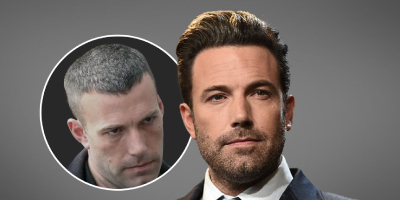 Ben Affleck Hair Transplant: The Truth Behind the Hollywood Star's Hairline