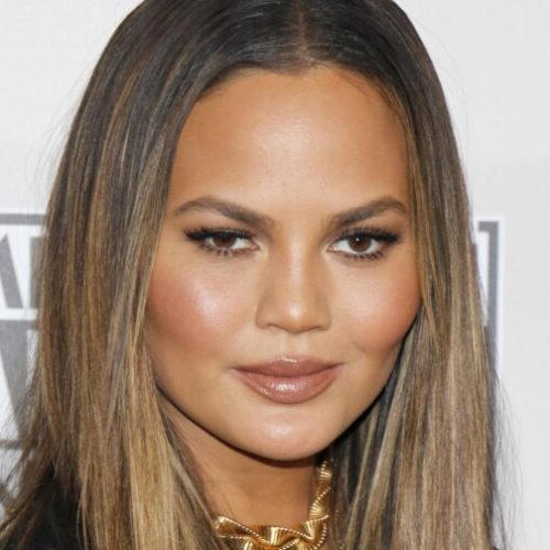 Chrissy Teigen Eyebrow Transplant