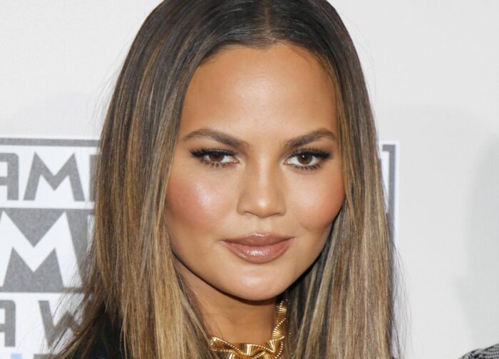 Chrissy Teigen Eyebrow Transplant: A Beauty Trend Explained 1 Chrissy Teigen Eyebrow Transplant