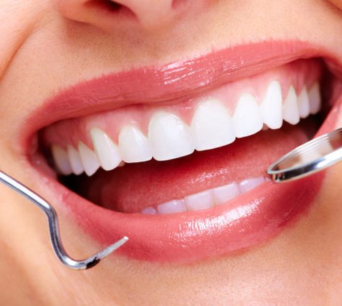 Cosmetic Dentistry Treatments: An Overview of Types, Procedures, and Costs