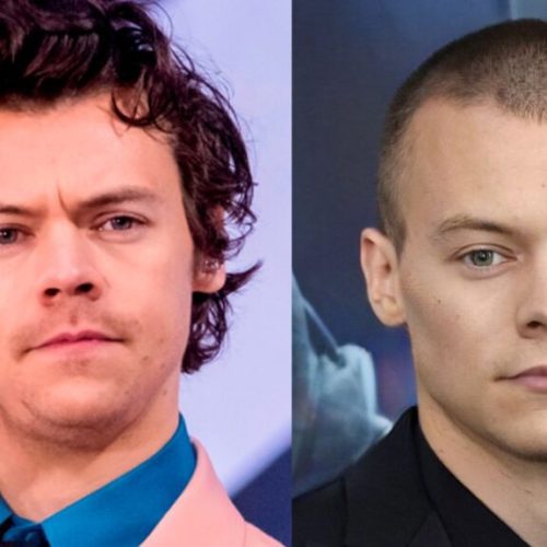 Did Harry Styles Get a Hair Transplant? Debunking the Rumors