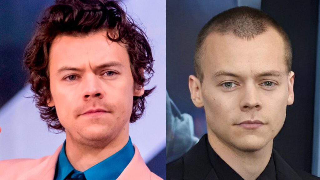 Did Harry Styles Get a Hair Transplant? Debunking the Rumors 1 Did Harry Styles Get a Hair Transplant? Debunking the Rumors