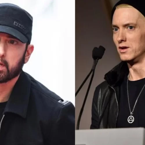 Eminem Beard Transplant: The Subtle Transformation of Slim Shady