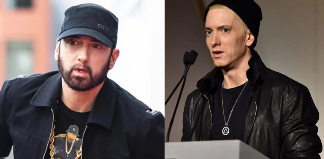 Eminem Beard Transplant: The Subtle Transformation of Slim Shady 1 Eminem Beard Transplant: The Subtle Transformation of Slim Shady