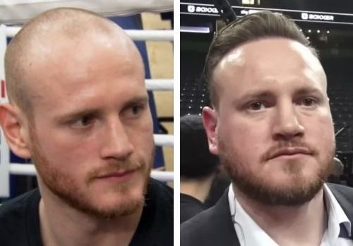 George Groves Hair Transplant